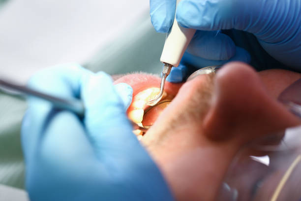 Best Broken Tooth Emergency  in Georgetown, SC