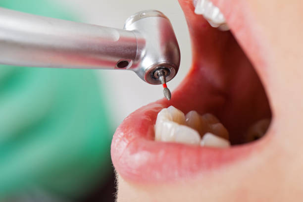 Best Urgent Tooth Repair  in Georgetown, SC
